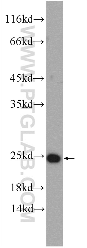 WB analysis of Recombinant protein using 21530-1-AP