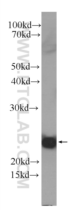 WB analysis of Recombinant protein using 60319-1-Ig