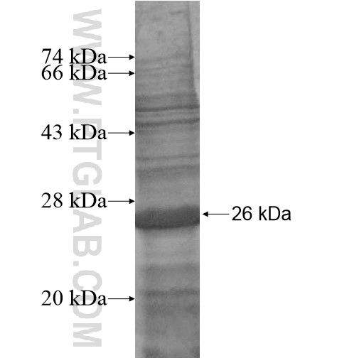 IL-1F5 fusion protein Ag14658 SDS-PAGE IL-1F5 fusion protein Ag14658 SDS-PAGE