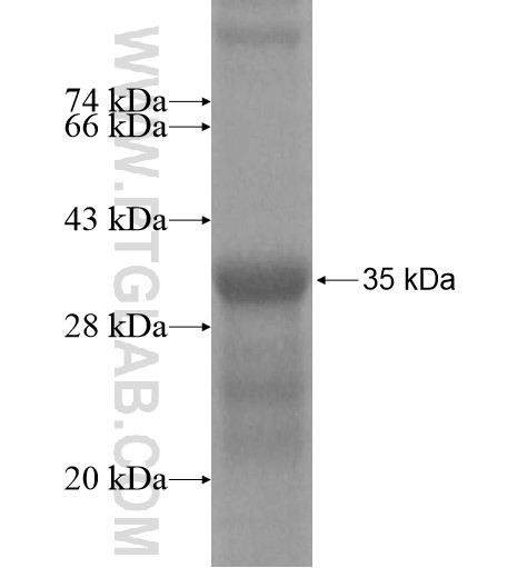 IL-1F6 fusion protein Ag15666 SDS-PAGE IL-1F6 fusion protein Ag15666 SDS-PAGE