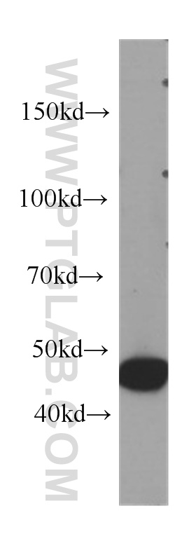 WB analysis of HeLa using 60262-1-Ig