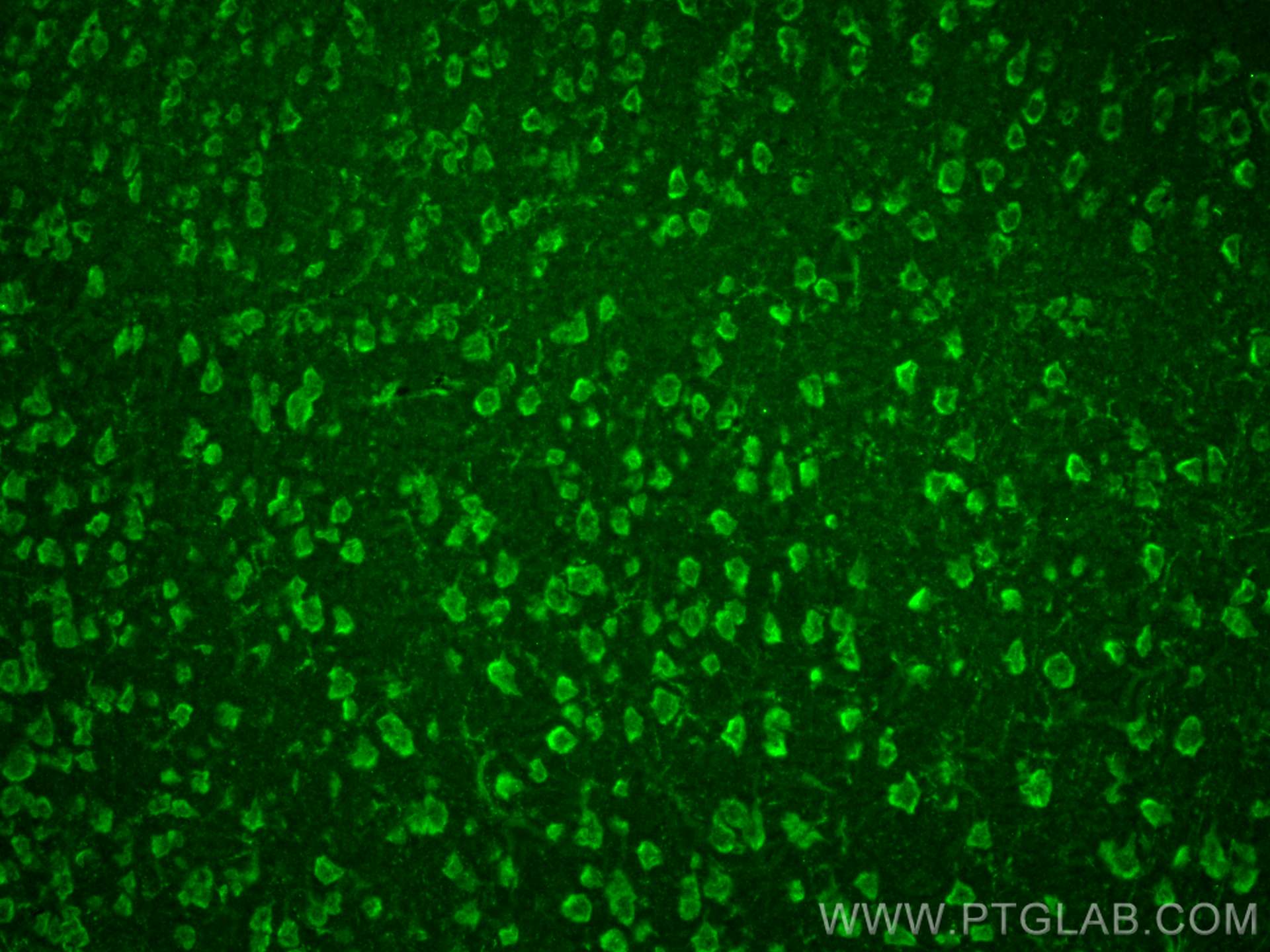 IF Staining of mouse brain using 21609-1-AP