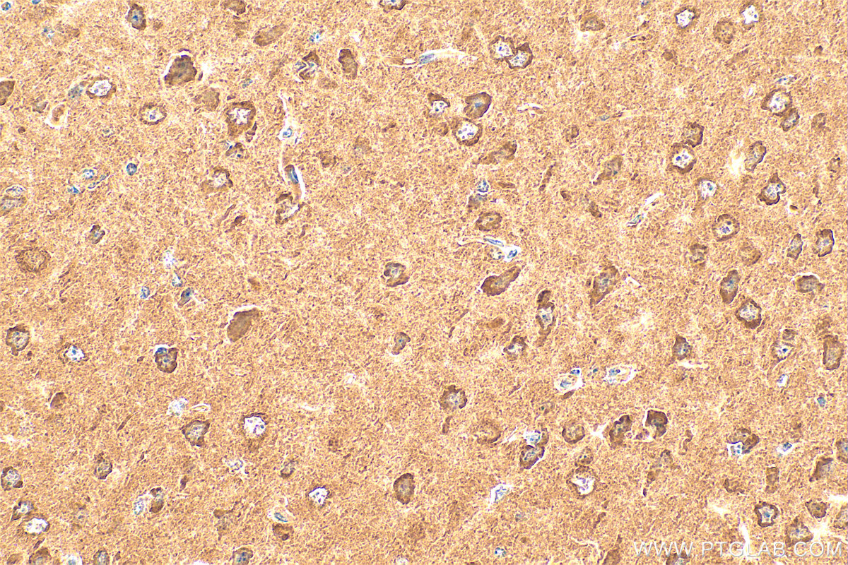 IHC staining of mouse brain using 21609-1-AP