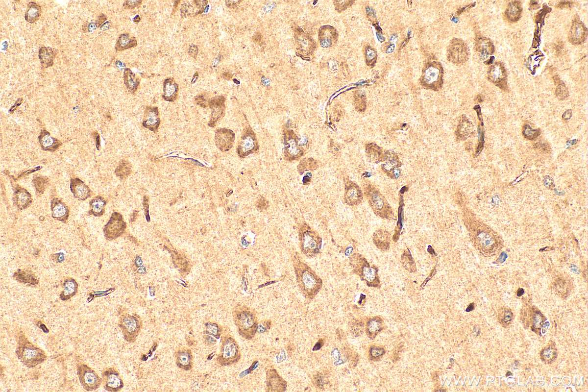 IHC staining of rat brain using 21609-1-AP