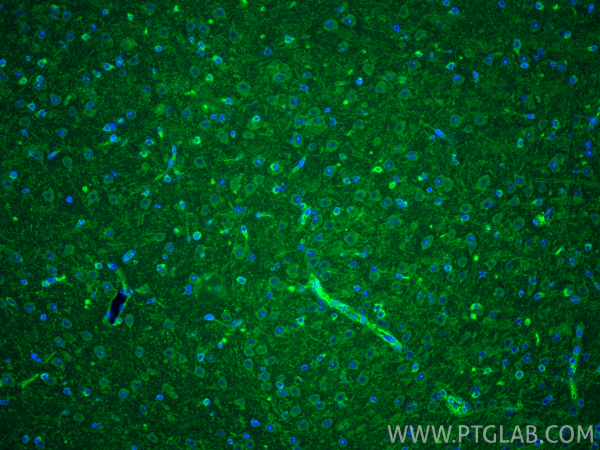 Immunofluorescent analysis of (4% PFA) fixed paraffin-embedded mouse brain tissue using IL-1RL1/ST2 antibody (11920-1-AP) at dilution of 1:400 and CoraLite®488-Conjugated Goat Anti-Rabbit IgG(H+L) (<a class='green' href='/productredirect?CatalogNo=SA00013-2' target='_blank'>SA00013-2</a>). Heat mediated antigen retrieval with Tris-EDTA buffer (pH 9.0). IF Staining of mouse brain using 11920-1-AP