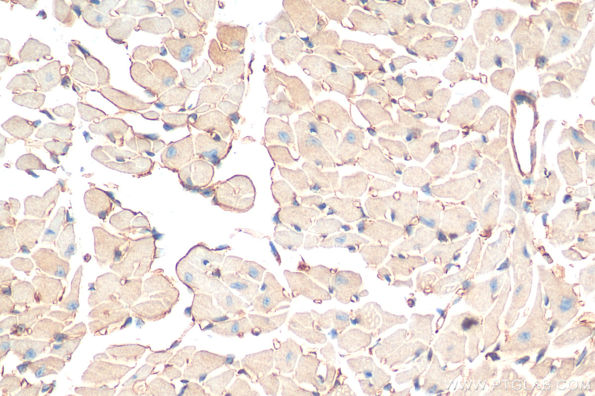 IHC staining of mouse heart using 11920-1-AP