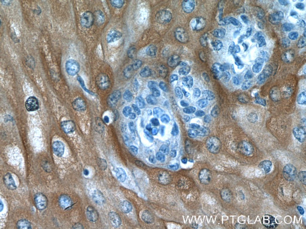 IHC staining of human oesophagus using 10844-1-AP