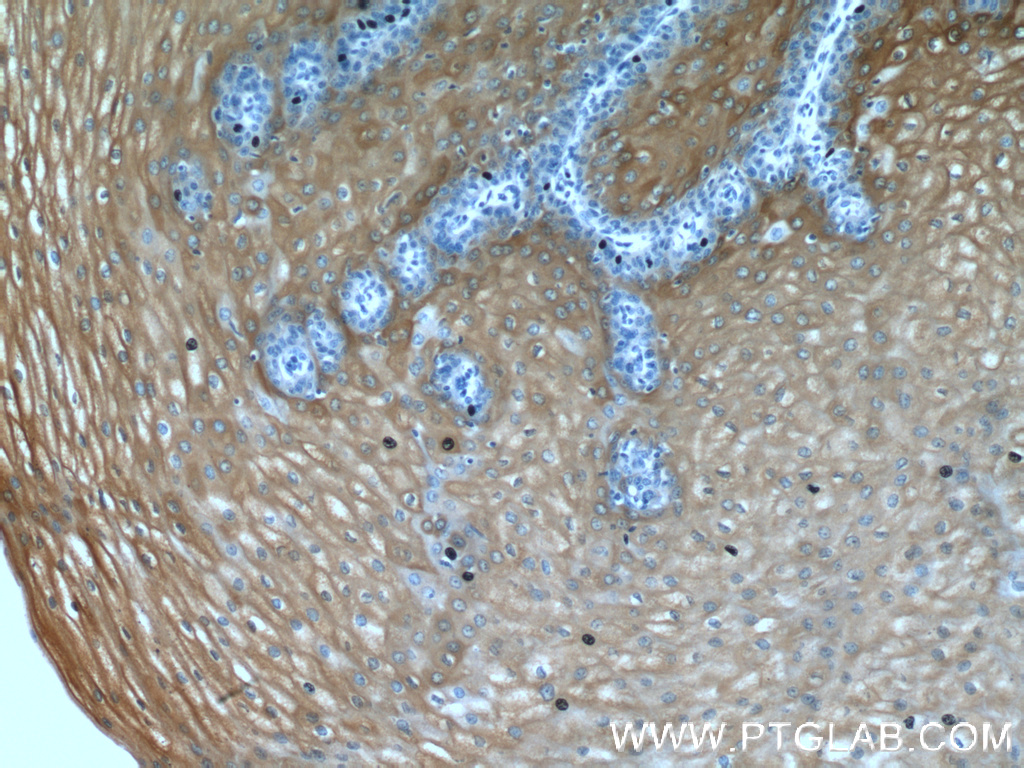 IL-1RA Polyclonal antibody