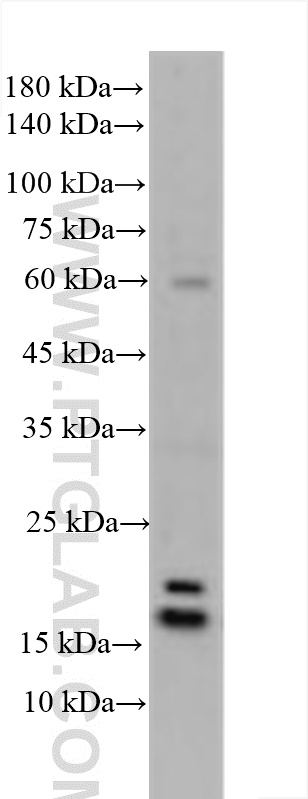 WB analysis using 10844-1-AP