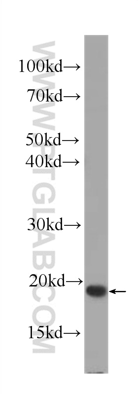 IL-2 Monoclonal antibody