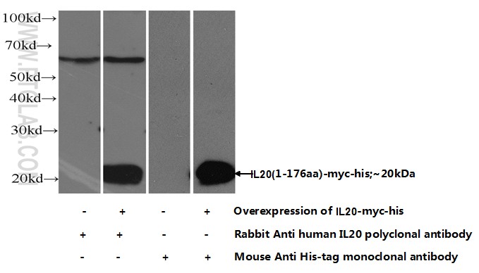 WB analysis of HEK-293 using 18104-1-AP