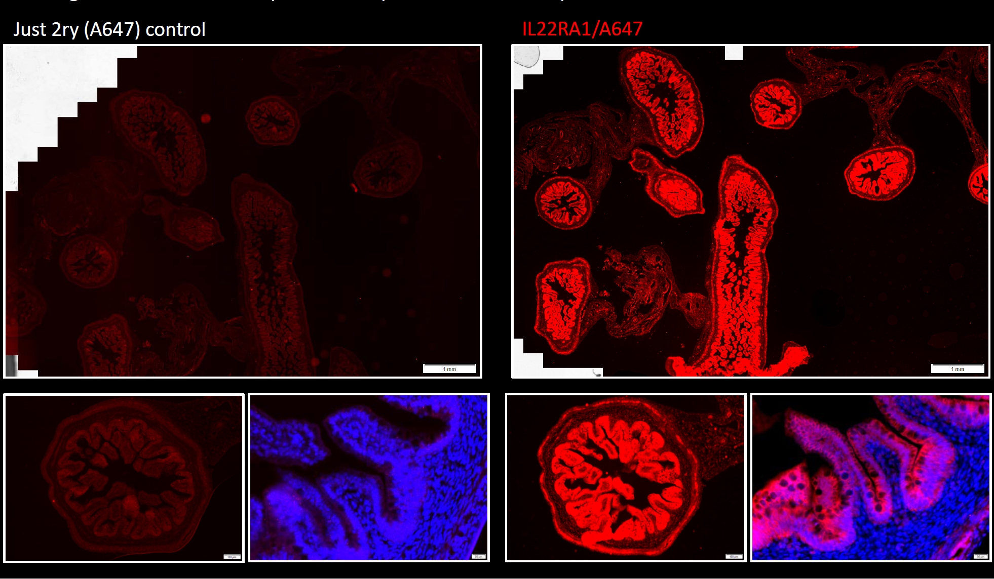 IF Staining of human gut using 13462-1-AP