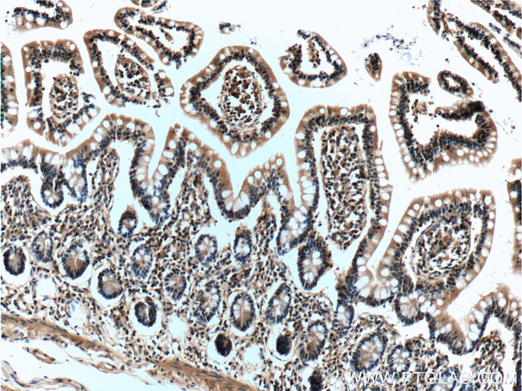 IHC staining of human small intestine using 66190-1-Ig (same clone as 66190-1-PBS)