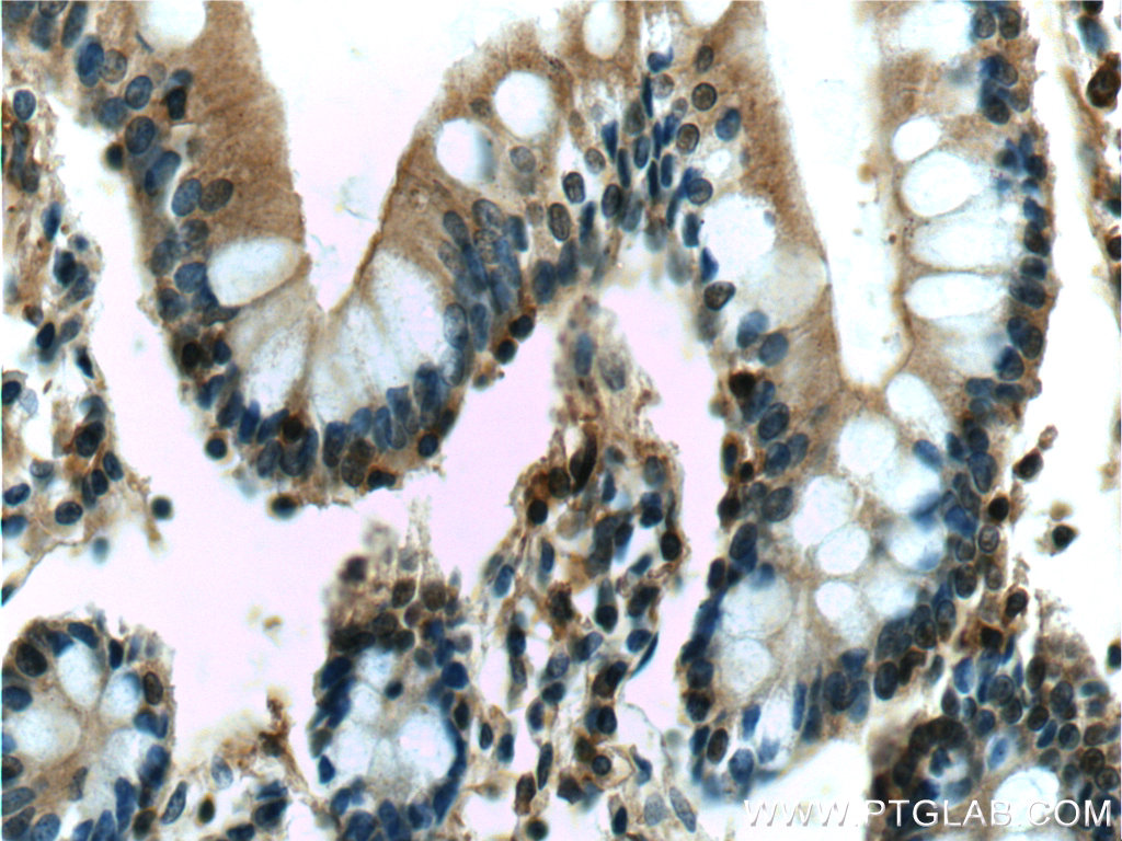 IHC staining of human small intestine using 66190-1-Ig (same clone as 66190-1-PBS)