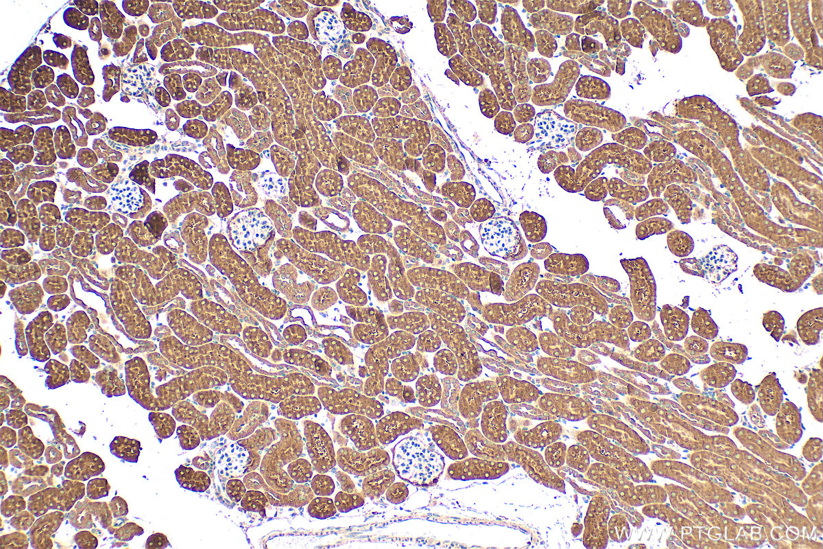 IHC staining of mouse kidney using 66190-1-Ig