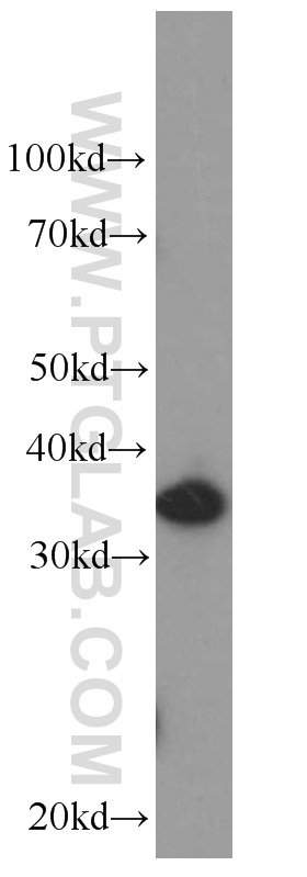 IL-22RA2 Monoclonal antibody