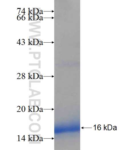 IL-23R fusion protein Ag25964 SDS-PAGE IL-23R fusion protein Ag25964 SDS-PAGE