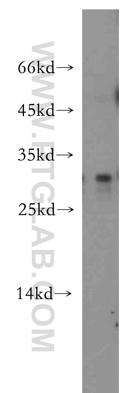 WB analysis of Recombinant protein using 12064-1-AP