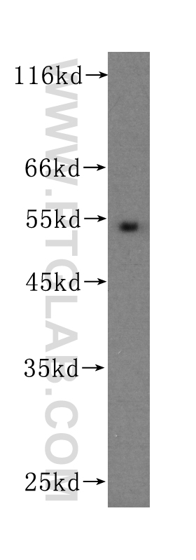 WB analysis of Recombinant protein using 60139-1-Ig