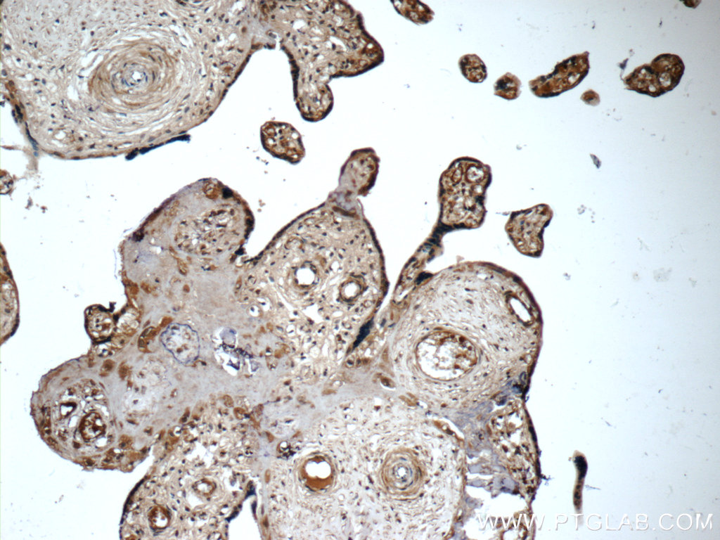 IHC staining of human placenta using 66164-1-Ig