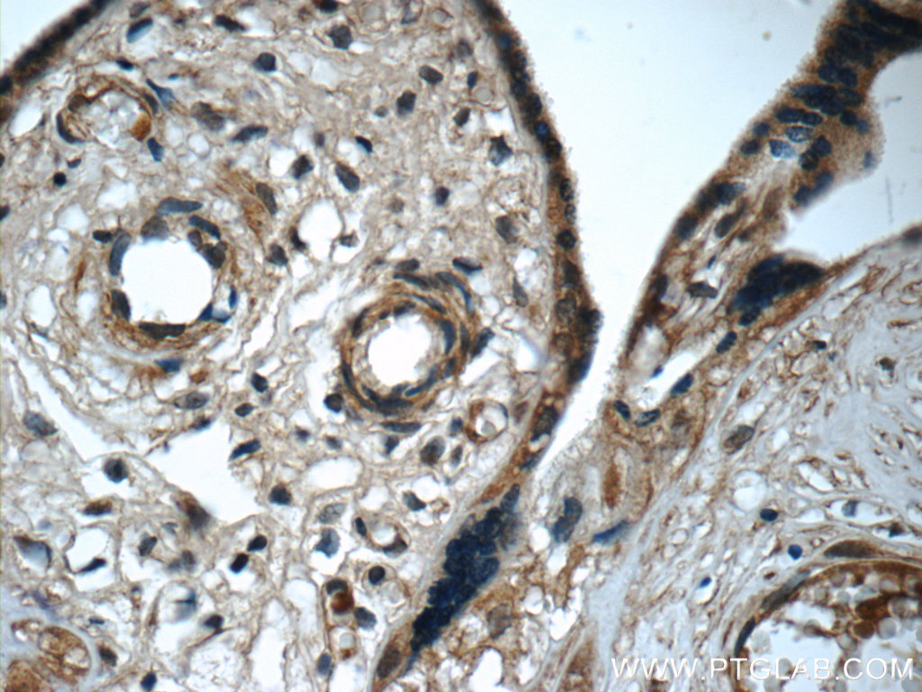 IHC staining of human placenta using 66164-1-Ig