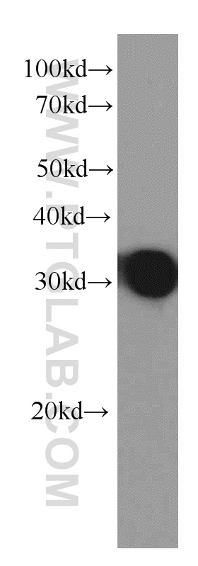 WB analysis of Recombinant protein using 66164-1-Ig