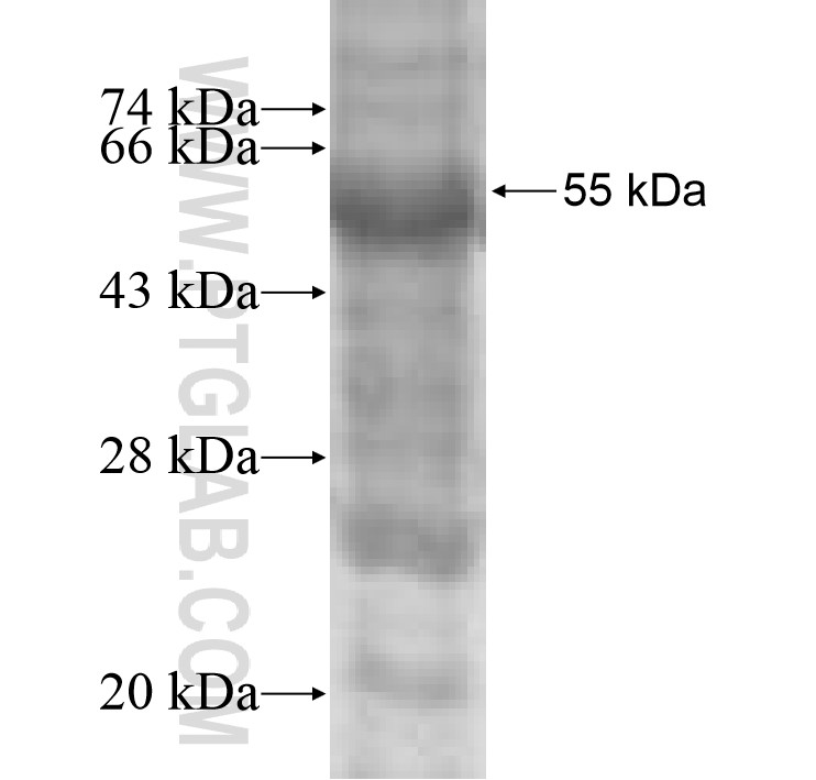 IL-27RA fusion protein Ag9133 SDS-PAGE IL-27RA fusion protein Ag9133 SDS-PAGE