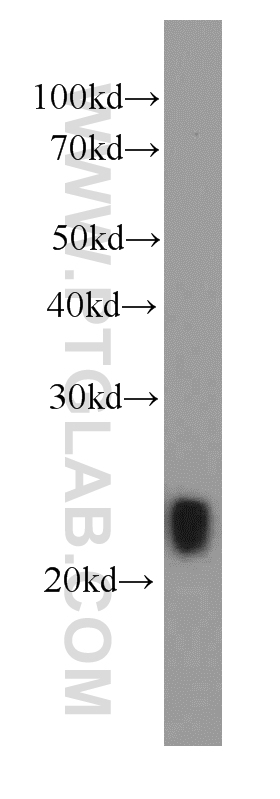 WB analysis of Recombinant protein using 66163-1-Ig