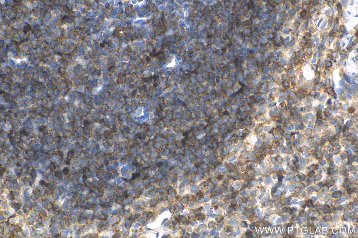 IHC staining of mouse spleen using 13602-1-AP