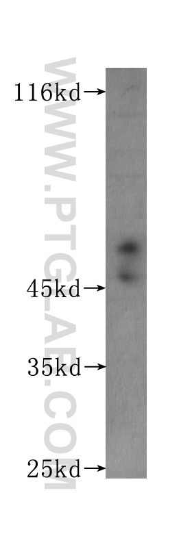 WB analysis of Recombinant protein using 60174-2-Ig (same clone as 60174-2-PBS)
