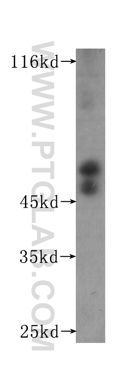 WB analysis of Recombinant protein using 60174-2-Ig