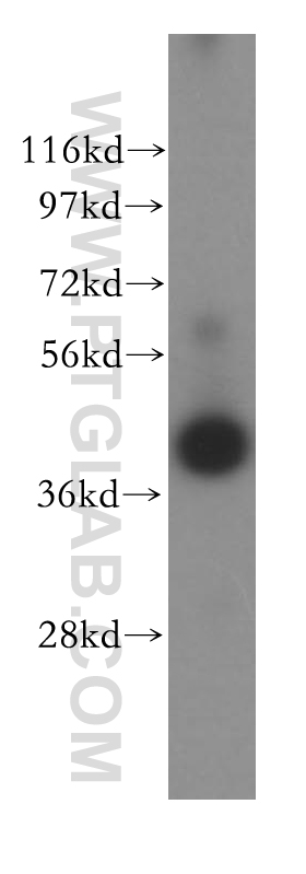 IL2RG Polyclonal antibody