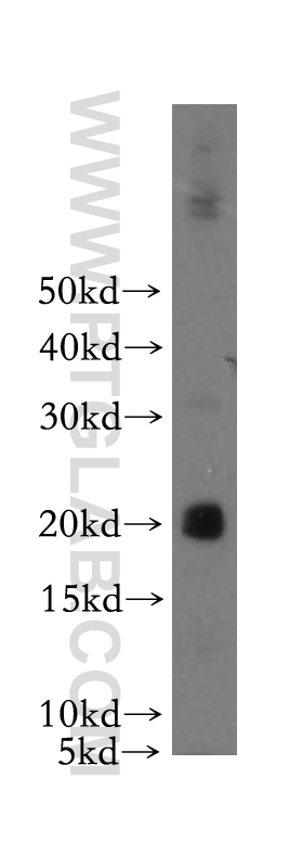 WB analysis of Recombinant protein using 17835-1-AP