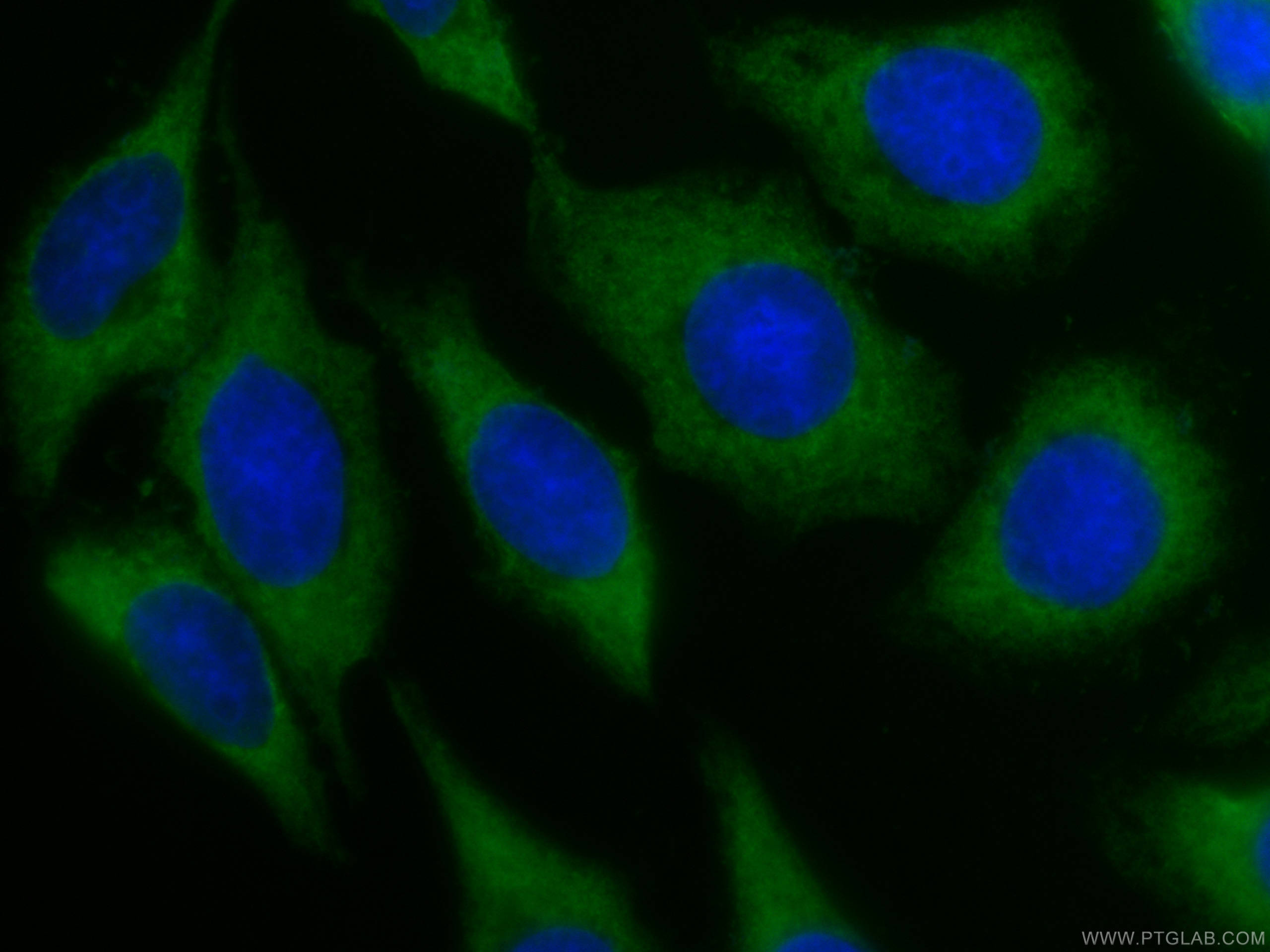 IF Staining of HepG2 using CL488-66235