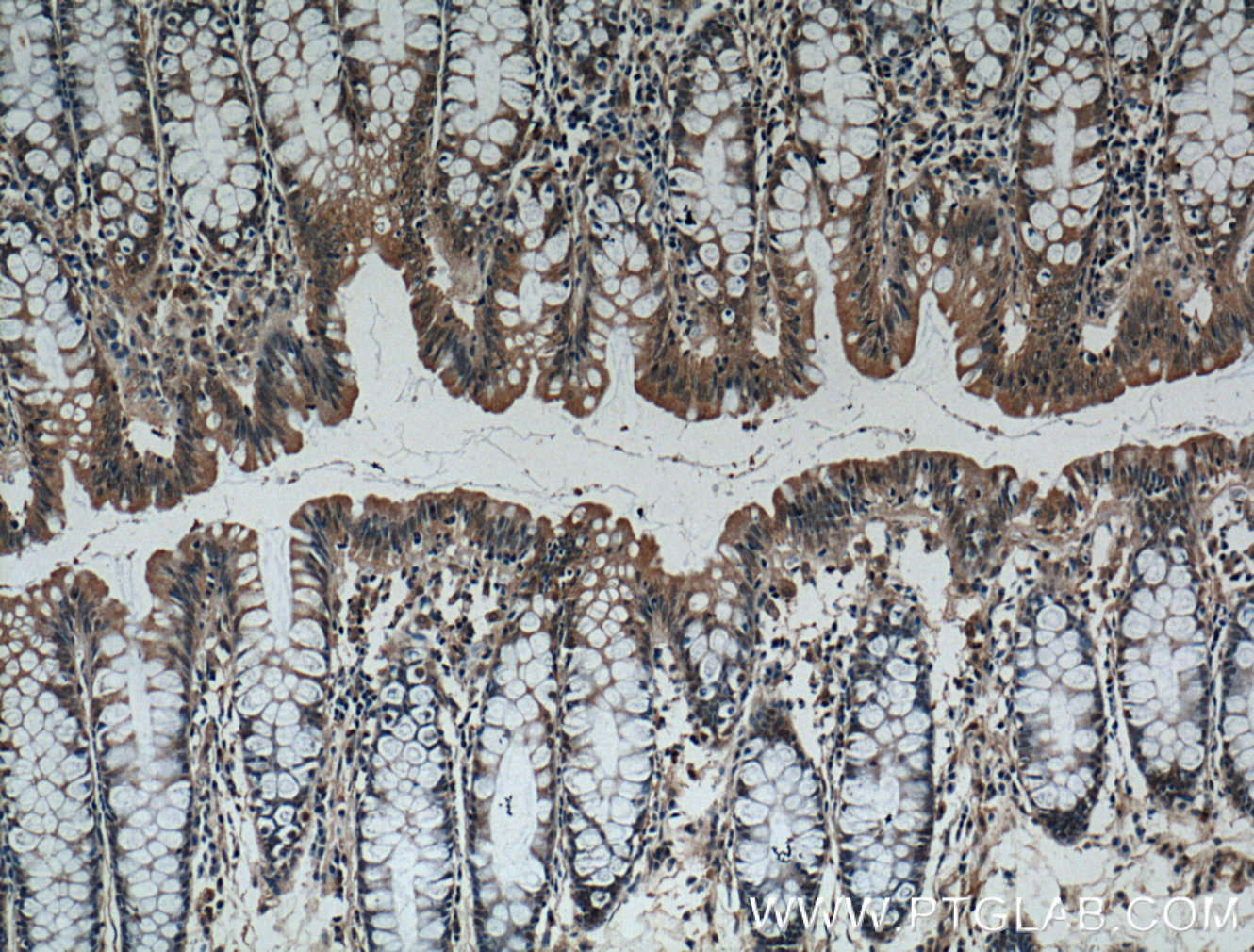 IHC staining of human colon using 60296-1-Ig