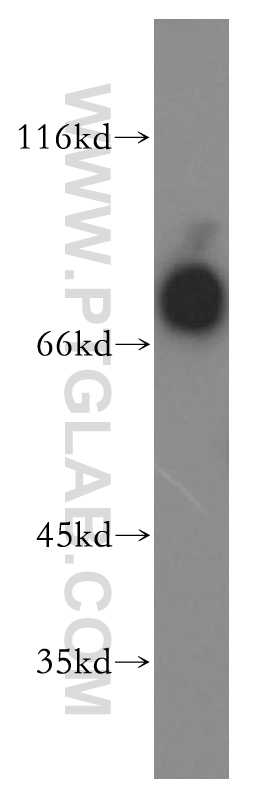 WB analysis of HL-60 using 13655-1-AP