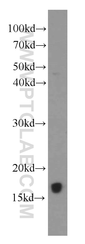 WB analysis of Jurkat using 66142-1-Ig