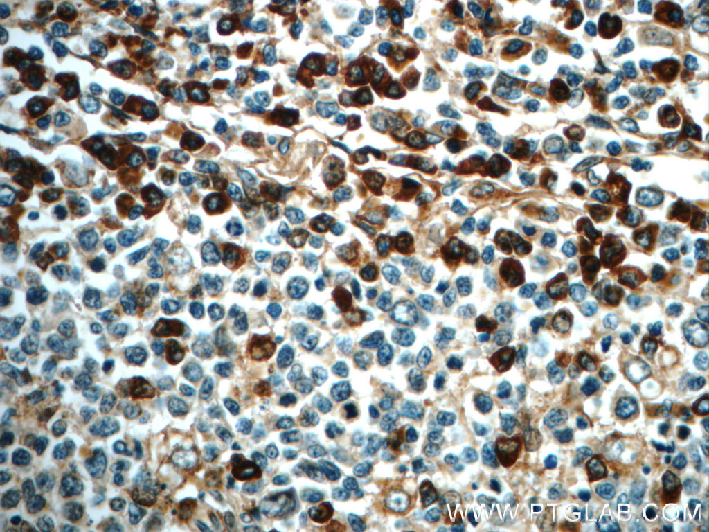 IL-6 Polyclonal antibody