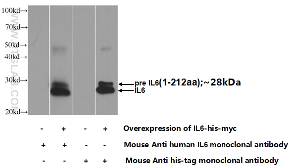 IL-6 Monoclonal antibody