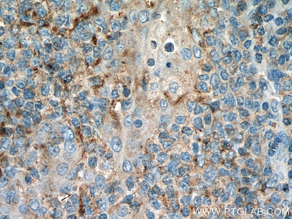 CD126/IL-6R alpha