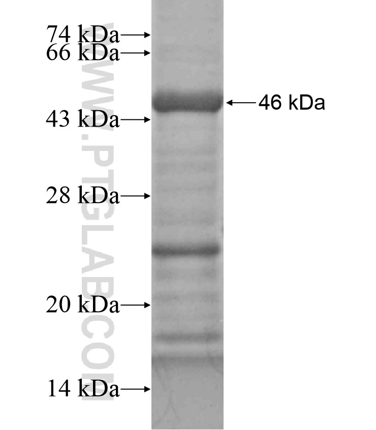 IL-6R fusion protein Ag18263 SDS-PAGE