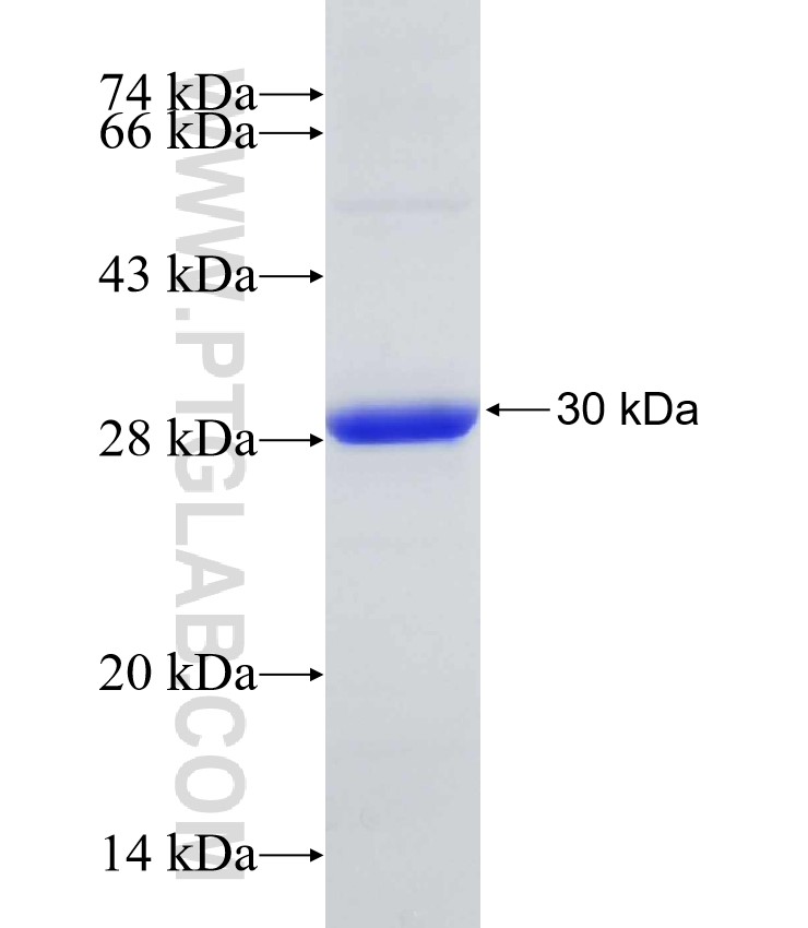 IL6ST fusion protein Ag31678 SDS-PAGE IL6ST fusion protein Ag31678 SDS-PAGE