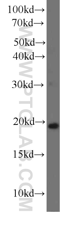 IL-7 Monoclonal antibody