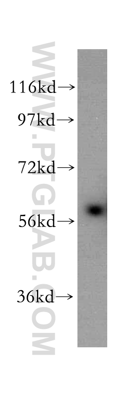 WB analysis of mouse thymus using 17626-1-AP