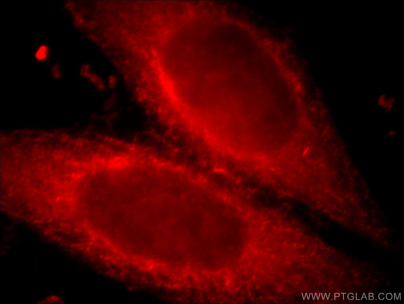 IF Staining of HepG2 using 20634-1-AP