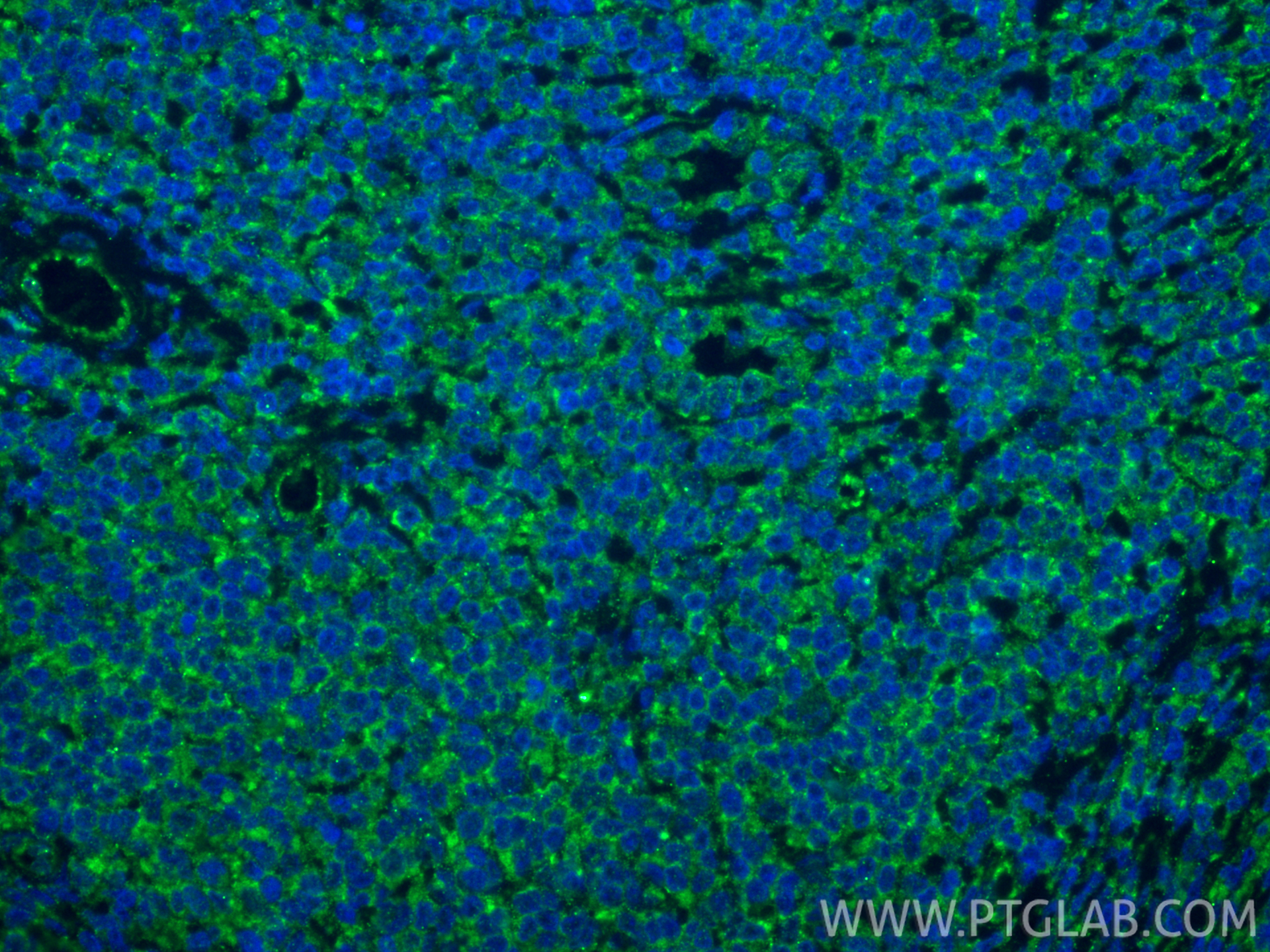 Immunofluorescent analysis of (4% PFA) fixed paraffin-embedded human tonsillitis tissue using IL-9 antibody (66144-1-Ig, Clone: 1F3A11 ) at dilution of 1:800 and CoraLite®488-Conjugated Goat Anti-Mouse IgG(H+L) (<a class='green' href='/productredirect?CatalogNo=SA00013-1' target='_blank'>SA00013-1</a>). Heat mediated antigen retrieval with Tris-EDTA buffer (pH 9.0). IF Staining of human tonsillitis using 66144-1-Ig