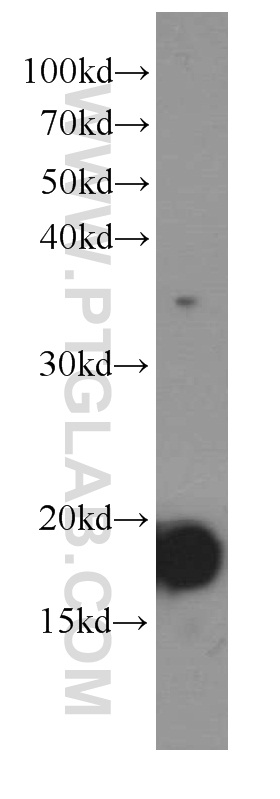 WB analysis of Recombinant protein using 66144-1-Ig