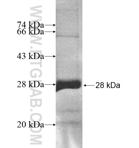 IL9R fusion protein Ag11209 SDS-PAGE IL9R fusion protein Ag11209 SDS-PAGE