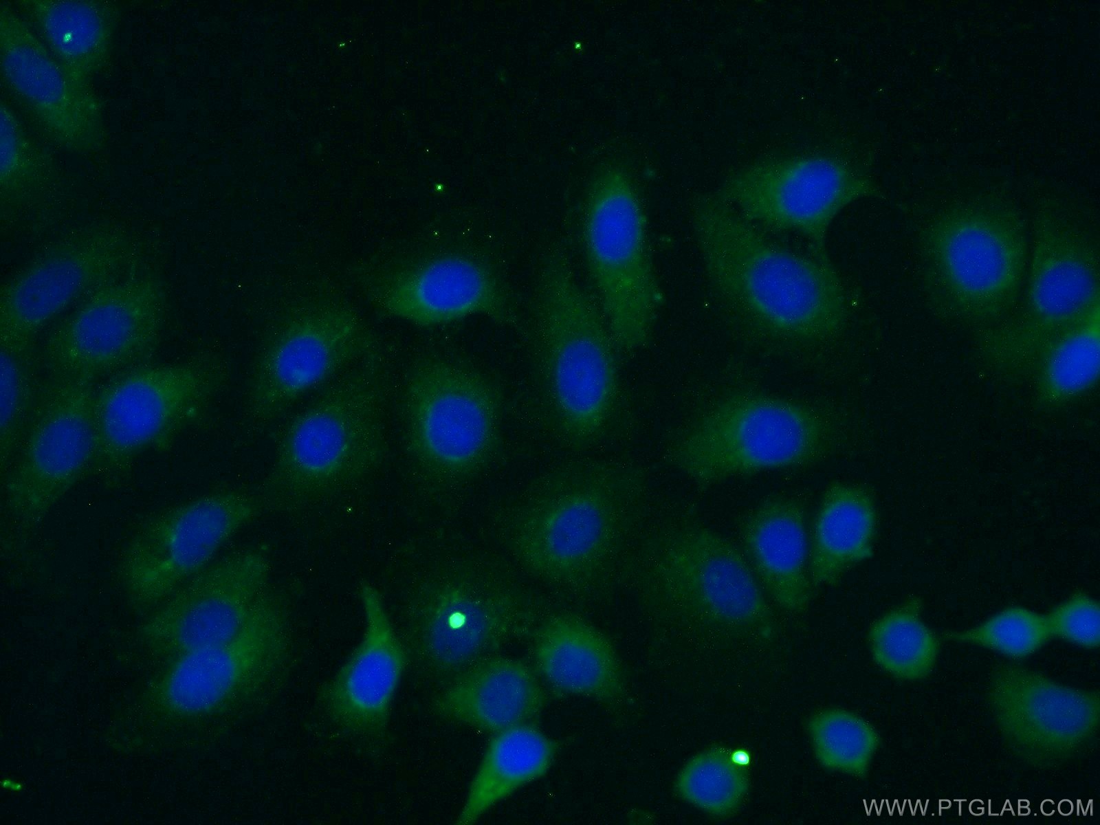 IF Staining of MCF-7 using 24926-1-AP