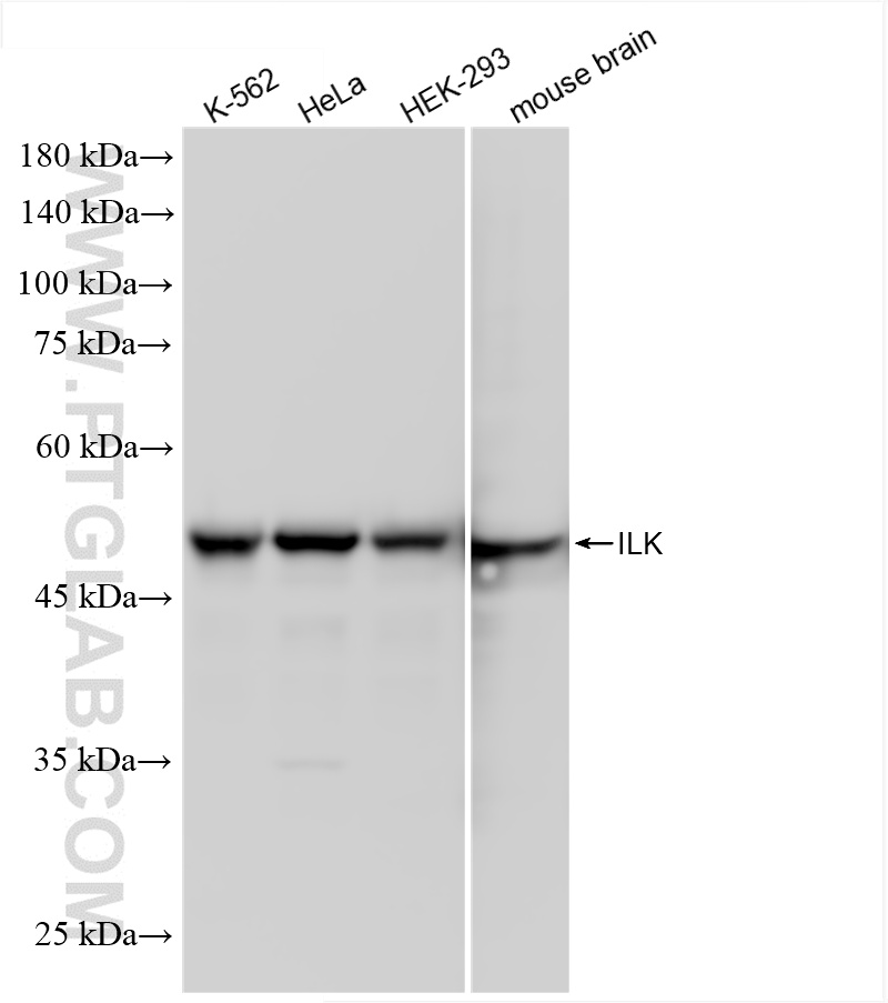 WB analysis using 85428-5-RR
